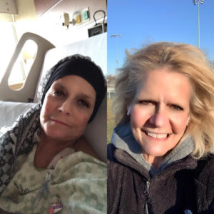 A before and after image of a cancer survivor