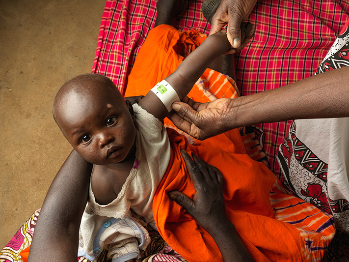 A baby in Kenya being checked for malnutrition using a mid-upper arm circumference (MUAC) band.